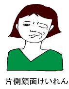 顔面痙攣の鍼灸治療