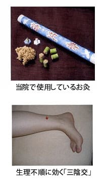 生理不順の鍼灸治療